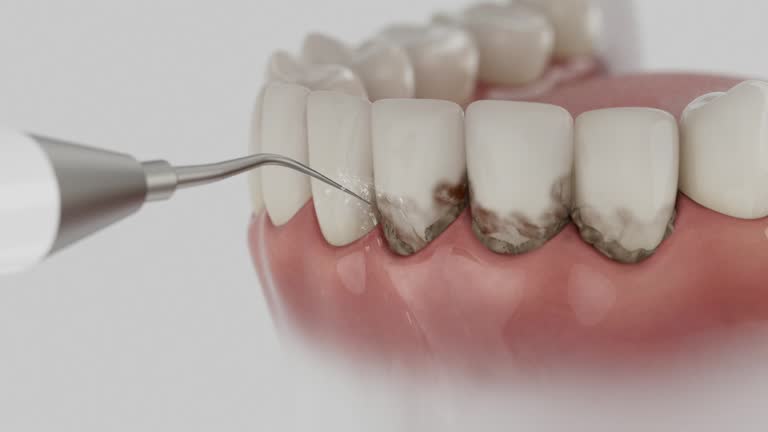 Trusted Wisdom Tooth Removal service in Childress, TX - Dentist Open Now